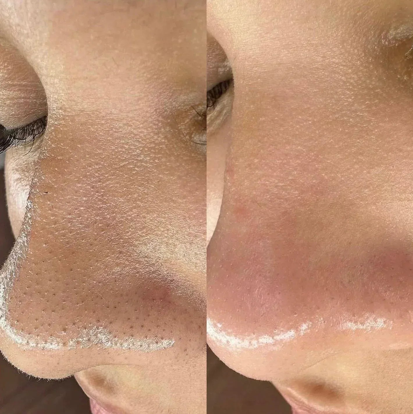 Dúo Coreano Dr Melaxin®