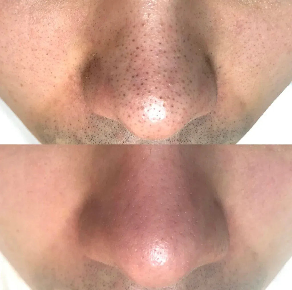 Dúo Coreano Dr Melaxin®